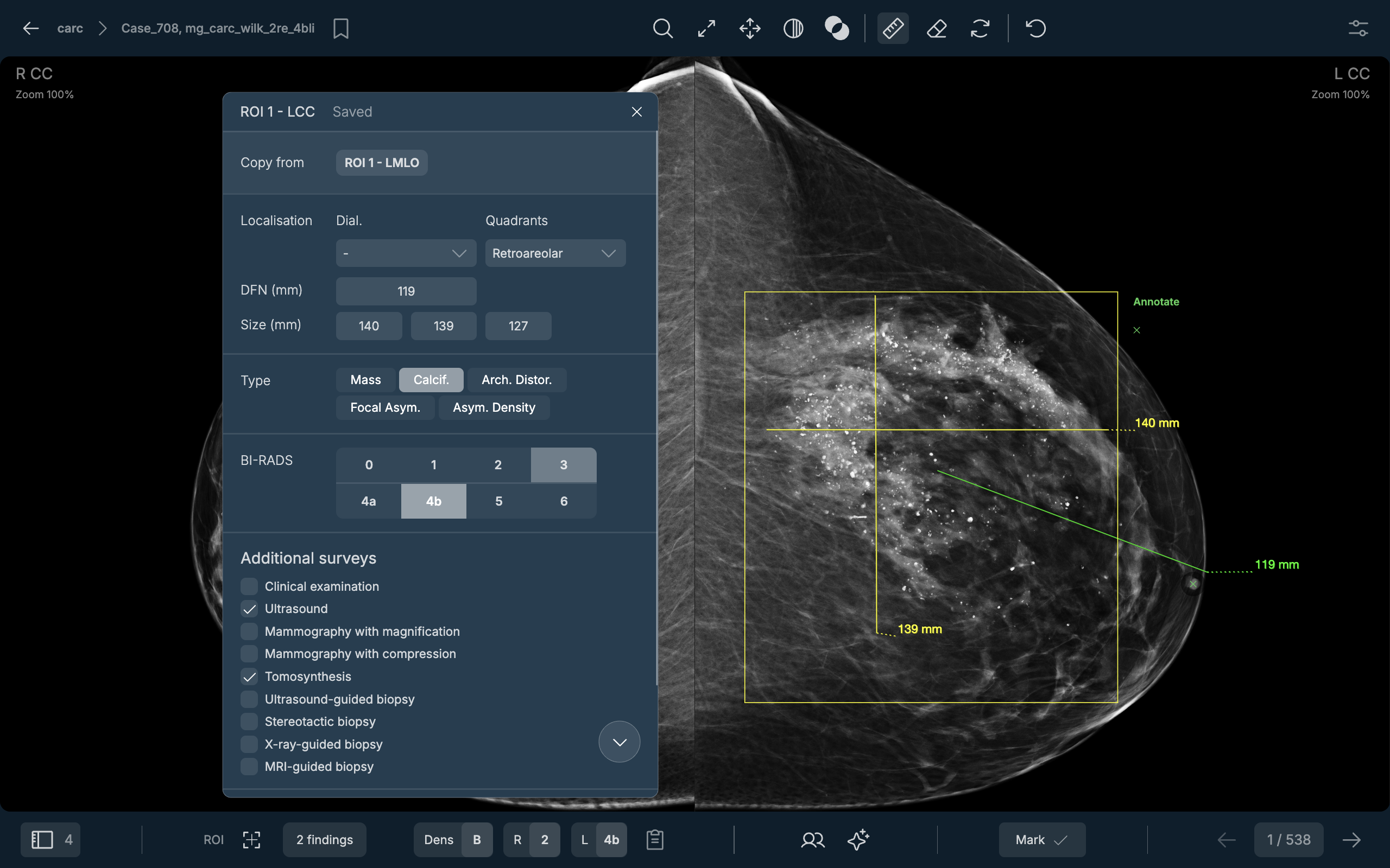 FINDING-LEVEL LABELS